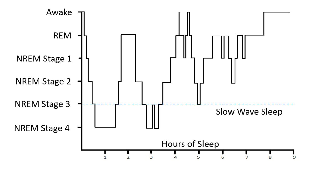 Why Sleep is So Important and How I Conquered My Chronic Insomnia